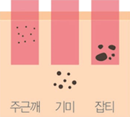일반 토닝