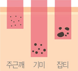 스타워커 토닝